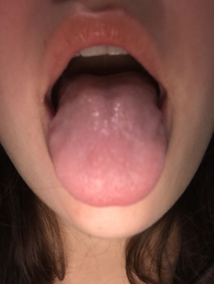 a woman sticking her tongue out to show it's large pinkish flesh on her lips