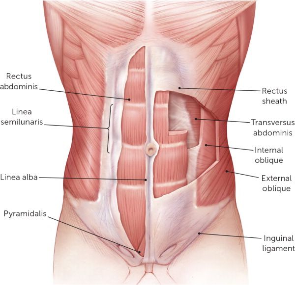 Lower Abdominal Pain, Differential Diagnosis, Referred Pain, Pinched Nerve, Abdominal Surgery, Muscle Abdominal, Muscle Anatomy, Patient Education, Stomach Pain