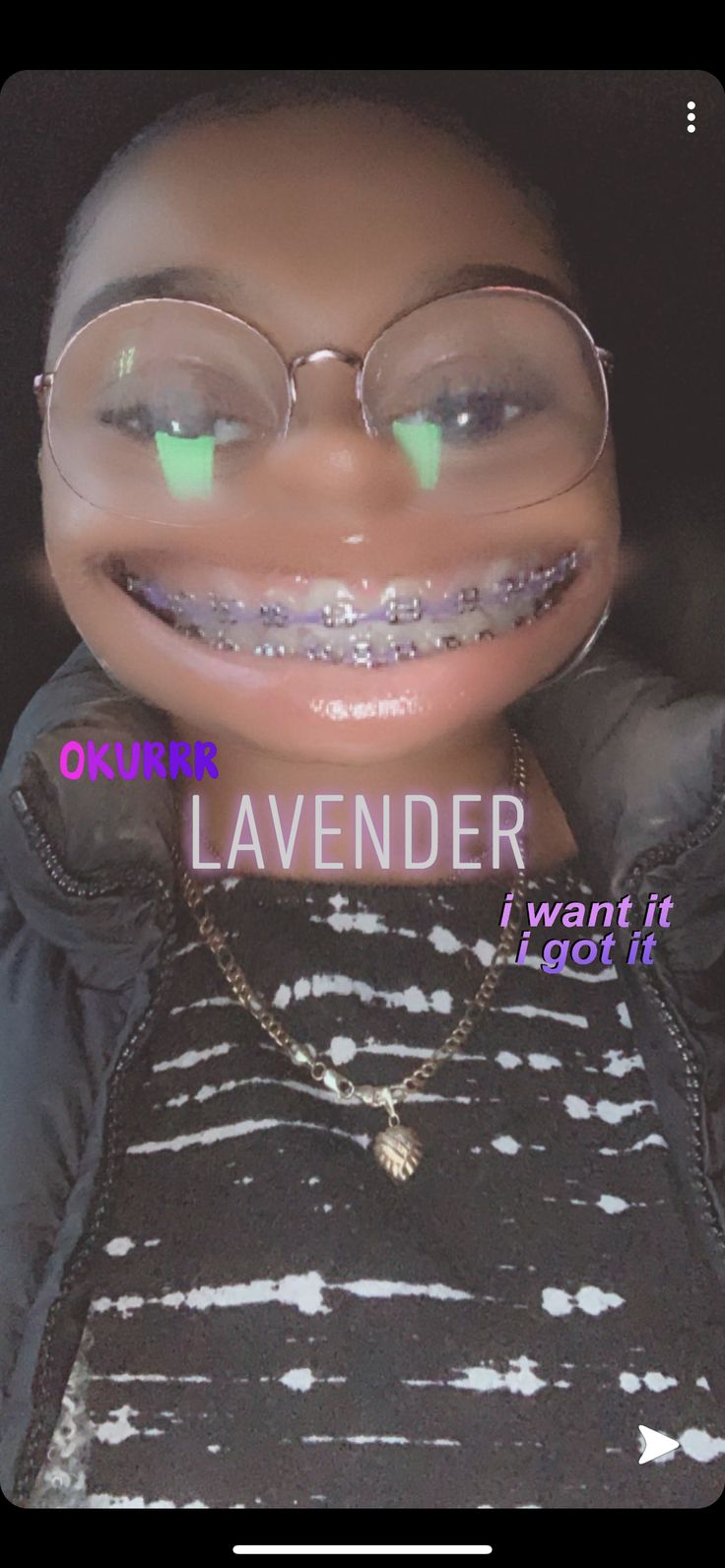 Lavender/Purple braces. Power chain. Ligature ties. Rubber bands Purple Braces, Power Chain Braces, Dental Braces Colors, Braces Colors Combinations, Invisible Teeth Braces, Braces Cute, Diy Braces, Natural Teeth Whitening Diy, Black Braces