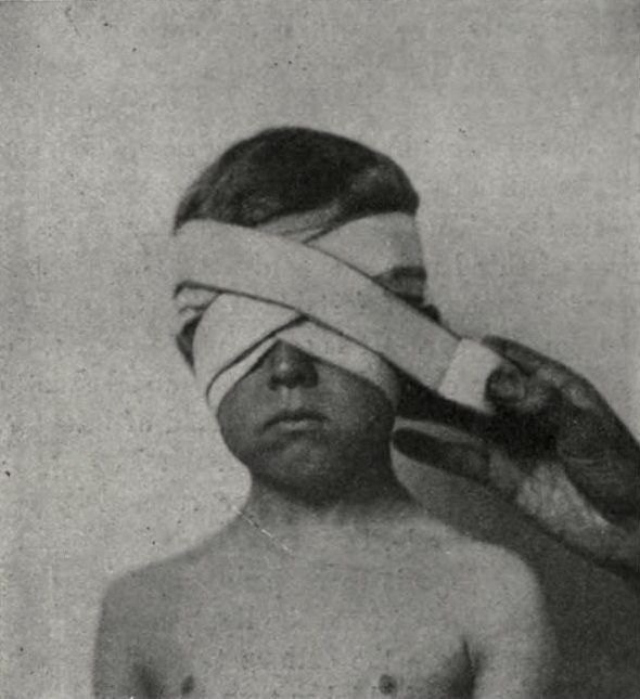 an old black and white photo of a boy with bandages on his head