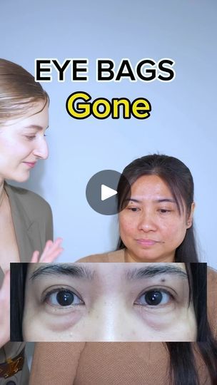 1M views · 13K reactions | EYE BAGS removed in 7 days!🔥

Learn proper face massage techniques to relax eye muscles, which will then help stimulate blood flow and remove excess lymph from the eye area. This will improve eye bags, dark circles, and even eye hollowness! 

If you want to try for yourself, I’ll be sharing face fitness techniques in my last webinar of this year! 🔥

#eyebags #puffyeyes #swolleneyes #facefitness #glowuptips 

Disclaimer: not a medical advice. For education purpose only. Consult with your physician if you have a medical condition. | Valeriia Veksler | Wheeler · what was I made for? (Instrumental) Eyebag Removal, Eye Muscles, Reduce Eye Bags, Face Fitness, Face Massage Techniques, Yoga Information, Swollen Eyes, Daily Exercise, Face Exercises