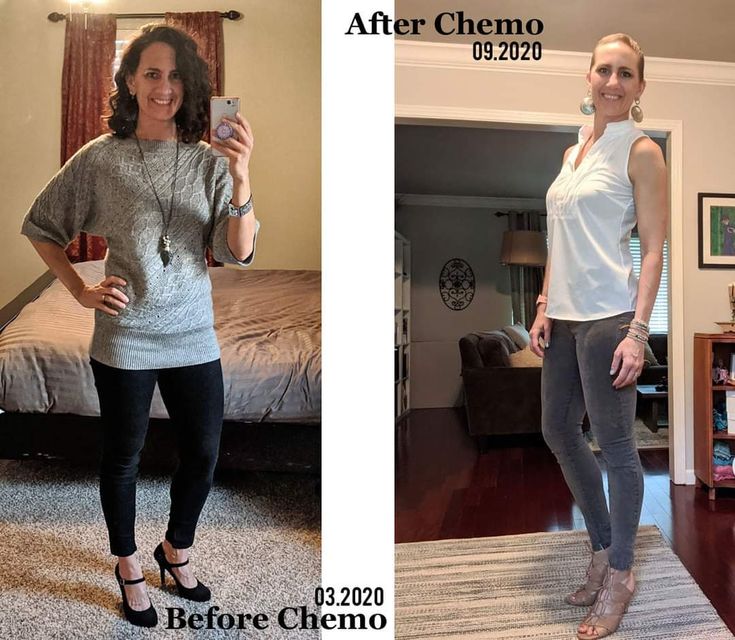 Working During Chemo, What To Wear For Chemo, Post Chemo Diet, Getting Through Chemo, Nutrition For Chemo Patients, Prepare For Chemo, What To Wear During Chemo, Foods To Eat During Chemo Diet, Exercise During Chemo