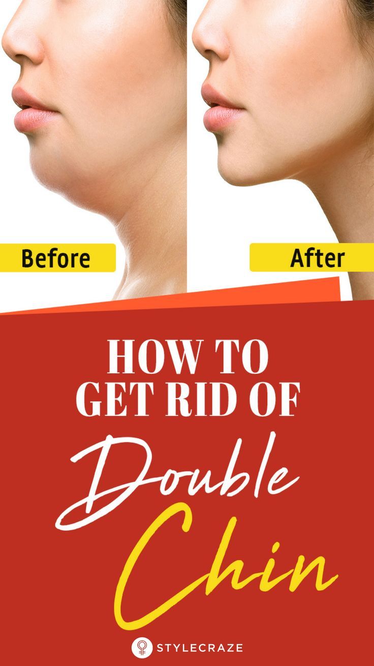 Get Rid Of Saggy Skin, Tighten Stomach, Rid Of Double Chin, Jawline Exercise, Double Chin Removal, Skin Tightening Stomach, Double Chin Exercises, Reduce Double Chin, Chin Exercises