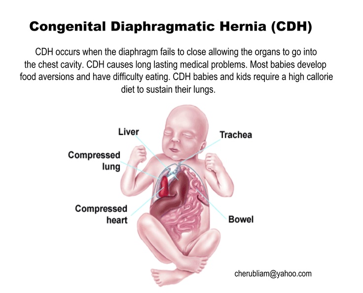 the diagram shows what happens are being performed in this baby's stomach and chest