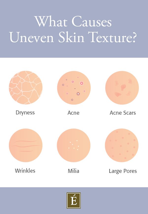 We’re all after #skin with a smooth surface, but the reality is that most of us experience uneven skin texture 😤 Learn more about what causes textured skin and how to improve it. ---- #skintexture #skincare #skincaretips How To Smooth Textured Skin, Uneven Skin Texture Skincare, Smooth Skin Quotes, How To Smooth Skin, How To Improve Skin Texture, Textured Skin Routine, Skincare For Textured Skin, How To Get Smooth Skin, Dry Textured Skin