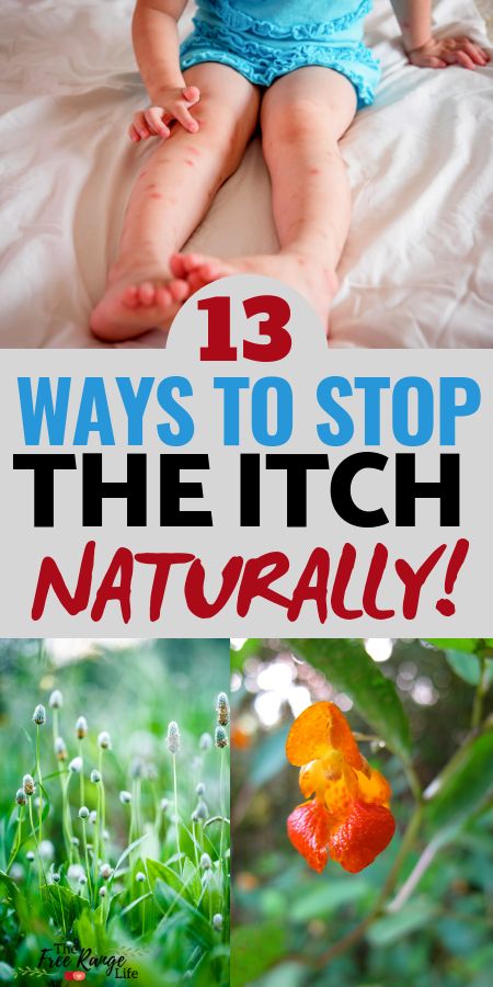 a baby sitting on top of a bed next to plants and flowers with the words 13 ways to stop the itch naturally