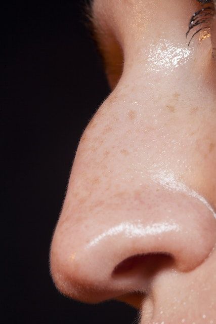 a close up of a person's nose and nose with white spots on it