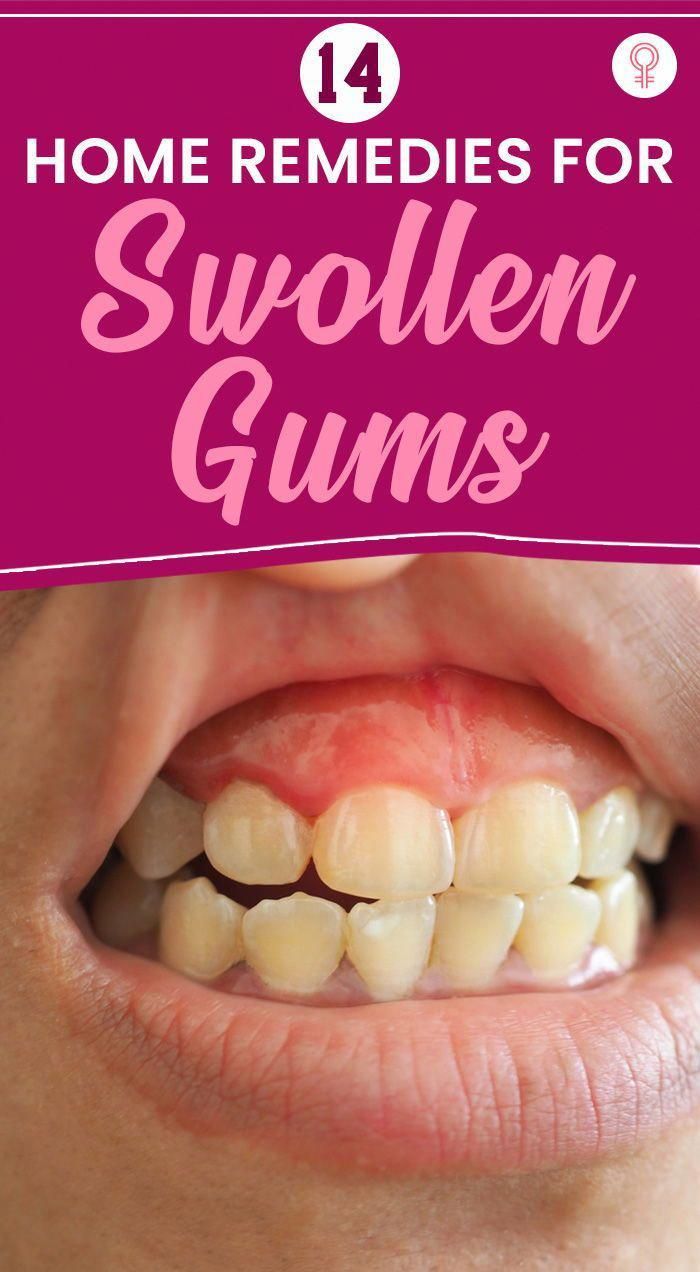 #WhyIsOralCareImportantInHospitals Swollen Gum, Improve Nutrition, Dental Cavities, Teeth Health, Tooth Sensitivity, Gum Care, Receding Gums, Gum Health, Oral Health Care