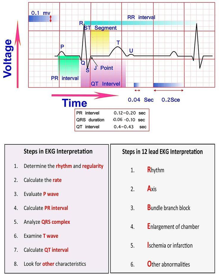 Learn ECG Interpretation 10 Steps to Learn ECG Interpretation Learning the art of ECG interpretation requires intellect, commitment,… Cardiac Nursing Cheat Sheets, Ekg Interpretation, Ecg Interpretation, Paramedic School, Nursing School Prerequisites, Nursing Information, Nursing Cheat, Nursing Mnemonics, Medical Student Study