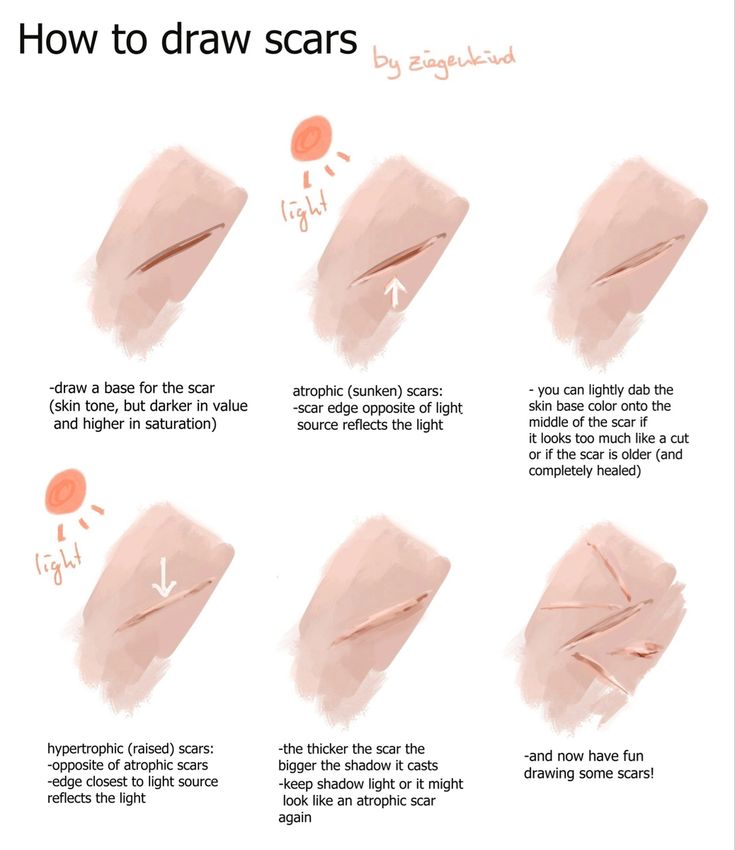 instructions for how to draw scars