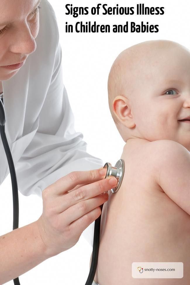 a baby being examined by a doctor with the words signs of serious lines in children and babies