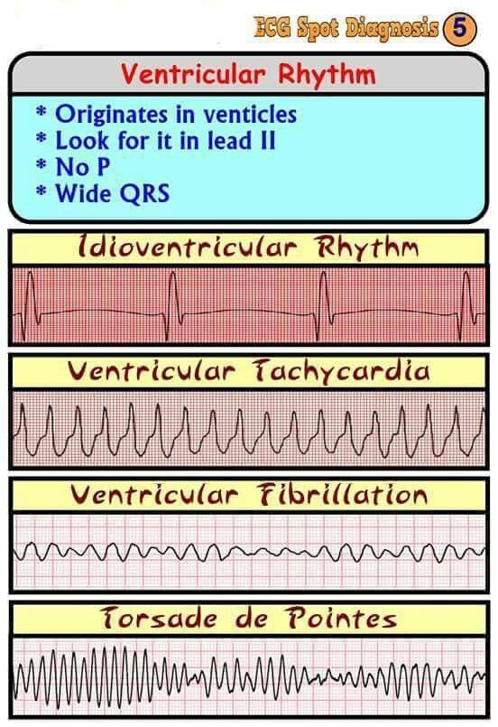 Telemetry Technician, Ekg Tech, Ekg Rhythms, Fitness Assessment, Nursing School Life, Cardiology Nursing, Ekg Interpretation, Ecg Interpretation, Paramedic School