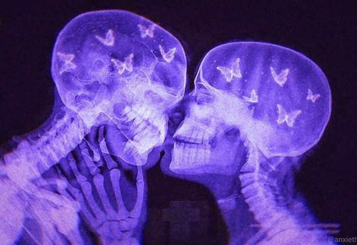 two skeletons kissing each other with butterflies on their heads in the dark, and one skeleton has its eyes closed