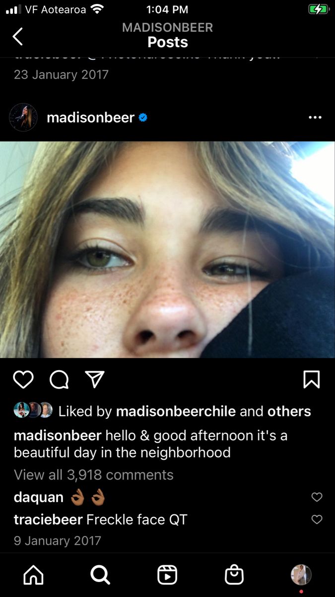 a woman with freckles on her face looking at the camera