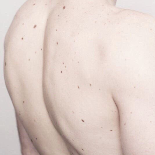 the back of a man with freckles on his body