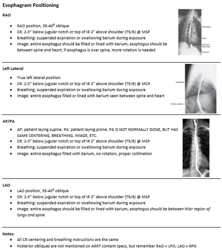 an image of the chest and ribs in this medical manual, which includes diagrams on how to