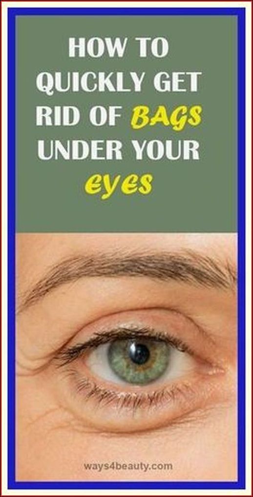 Say Goodbye to Eye Fat Bumps Naturally! Dry Eyes Remedy How To Get Rid, How To Get Rid Of Tired Eyes, Bump On Eyelid, How To Make The Whites Of My Eyes Whiter, White Bump On Eyelid, Fitness Planner, Bump