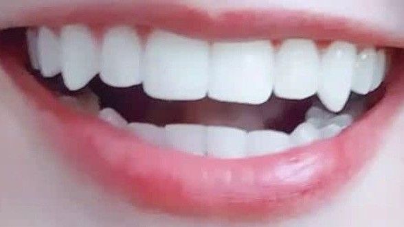 Fang Teeth Natural Aesthetic, Fang Teeth Aesthetic, Perfect Teeth Aesthetic Vampire, Teeth With Natural Fangs, Lips Claims For Dr, Fang Teeth Natural, Lip Claims For Dr, Eyelash Claims For Dr, Natural Vampire Teeth