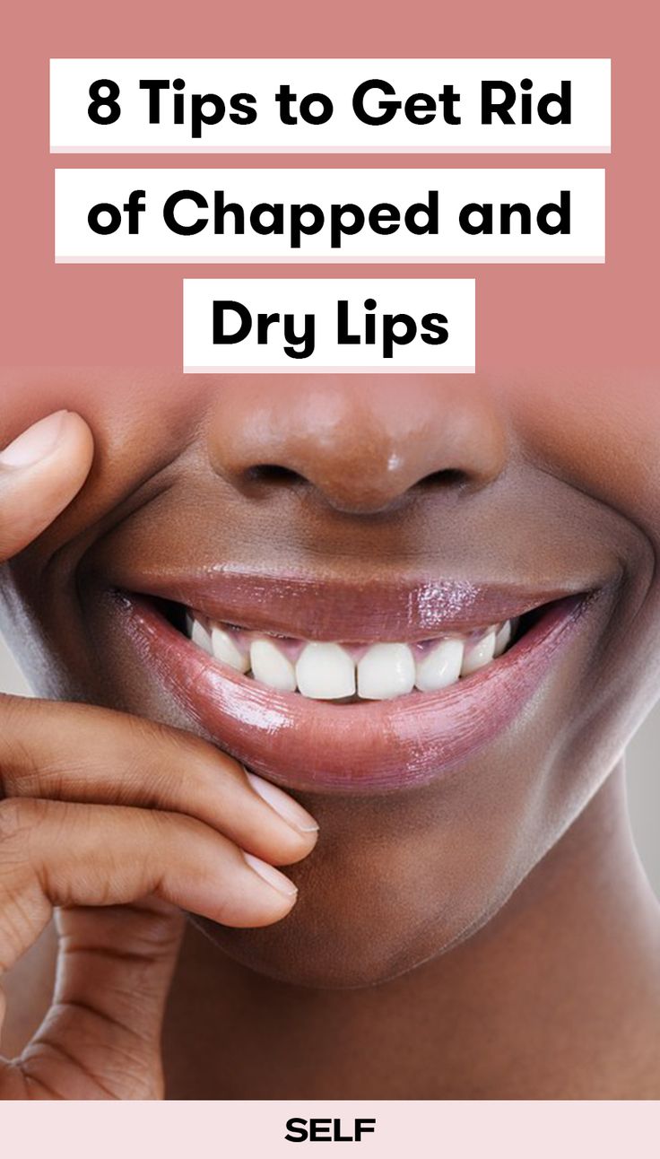 Looking for a severe chapped lips remedy as the weather gets colder? These simple products will help dry lips stay moisturized. Peeling Lips Remedies, Chap Lips Remedy, Severely Chapped Lips Remedy, Dry Chapped Lips Remedy, Heal Chapped Lips Fast, Remedy For Dry Lips, Hydrated Lips Tips, Natural Lip Moisturizer, Tips For Dry Lips