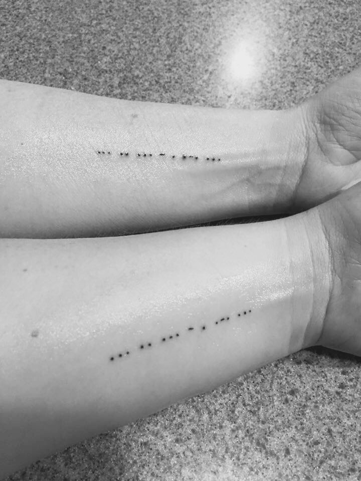 two people's legs with small black dots on them, one is holding the other