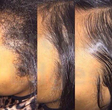 4 Tips To Make Your Edge Control More Effective Edge Control, Pelo Afro, Black Hair Care, Natural Hair Tips, Relaxed Hair, Natural Hair Journey, Hair Gel, Hair Journey, Hair Care Tips