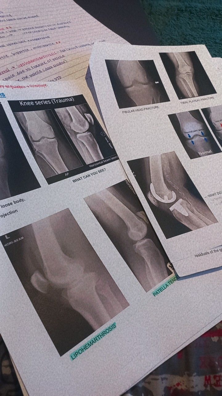 several pictures of different types of bones on top of papers with information about the human body