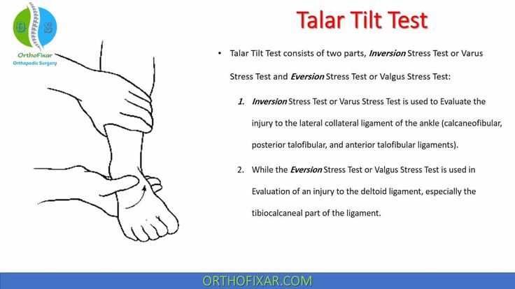 Talar Tilt Test consists of two parts, Inversion Stress Test or Varus Stress Test and Eversion Stress Test or Valgus Stress Test. Homans Sign, Clinical Trials Study, Dupuytren's Contracture, Flexibility Test, Ankle Anatomy, Ankle Ligaments, Nurse Practioner, Yoga Facts, Sports Therapy