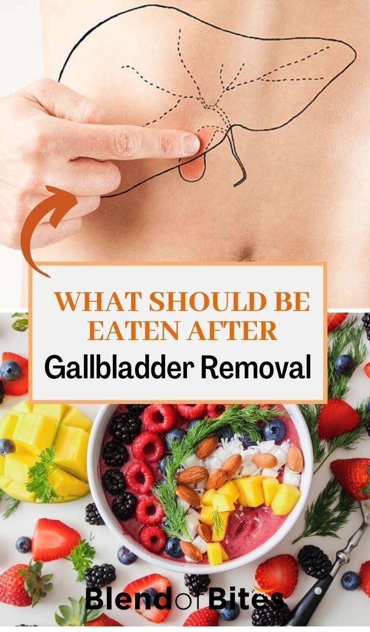 Post Gallbladder Surgery Diet, Gallbladder Surgery Diet, Gallbladder Removal Diet, After Gallbladder Removal, Healthy Eating Routine, After Gallbladder Surgery, Gallbladder Removal, Gallbladder Diet, Eating Routine