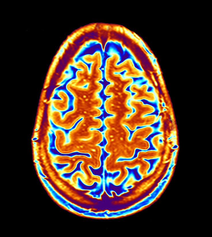 an image of the brain in orange and blue