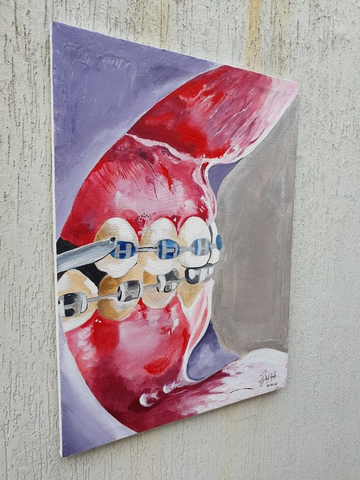 Dentist Painting, Dental Painting, Medical Collage, Dentistry Art, Dental Wall Art, Tooth Art, Dentist Art, Teeth Art, Dental Art