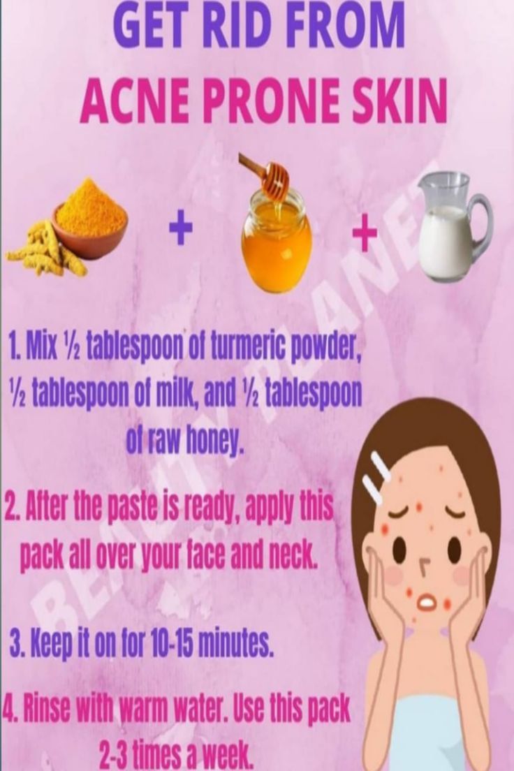 Face Pack For Acne, Face Routine, Good Skin Tips, Face Pack, Best Skin Care Routine, Morning Skin Care Routine, Best Face, How To Get Rid Of Acne, Raw Honey