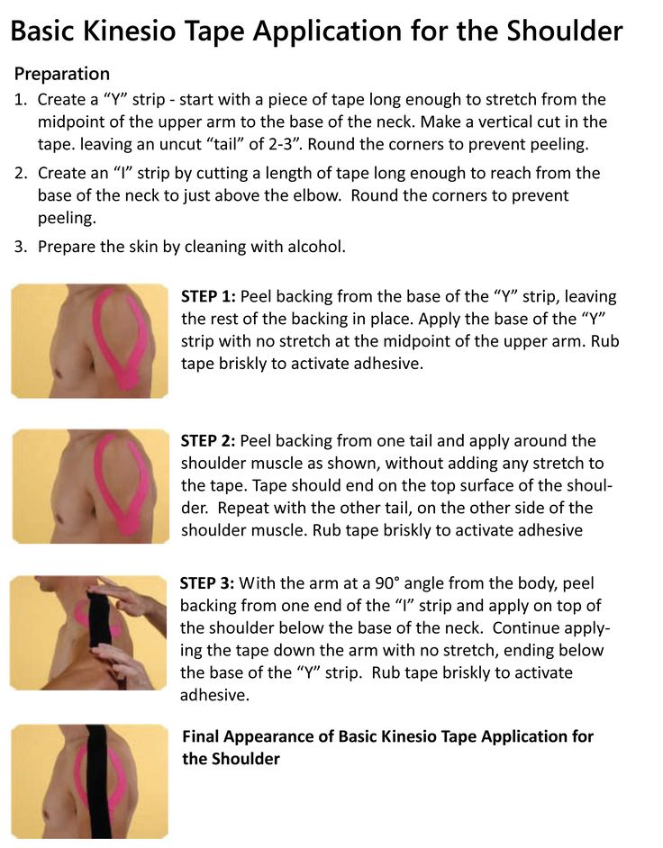 Basic Kinesio Tape Application for the Shoulder Kinesio Taping Shoulder, Physio Tape, K Tape, Kt Tape, Rotator Cuff Injury, Kinesio Taping, Sports Therapy, Kinesiology Taping, Rotator Cuff