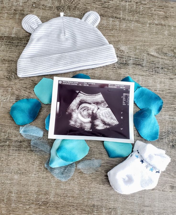 a baby's diaper and hat laying on top of blue flower petals next to an x - ray photo