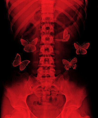 an x - ray image of a man's back with butterflies flying around