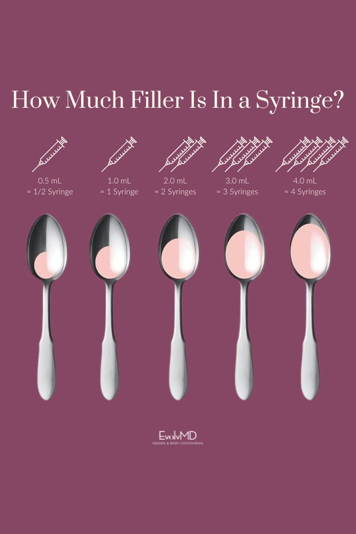 One syringe of filler is only equal to 1/5 of a teaspoon! Tiny.  When you are in your 30s and 40s and start to see noticeable volume loss, on average, you can expect to use about one syringe of filler for every decade to offset volume loss due to age. In your 30s, one syringe will soften deep lines, two will fill them, and three will help restore them. Click for more. #skincare #skincaretips #glowingskin #antiaging #milwaukee 1 Syringe Lip Filler, Hyaluronic Pen, Botox Quotes, Dermal Fillers Lips, Cosmetic Nurse, Skincare Facts, Face Fillers, Ad Ideas, Minimize Wrinkles