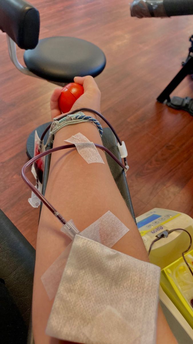 a person with an apple on their arm in a hospital room next to other medical equipment