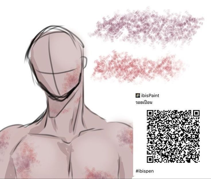 the back of a man's head and neck with red spots on it, next to a qr code