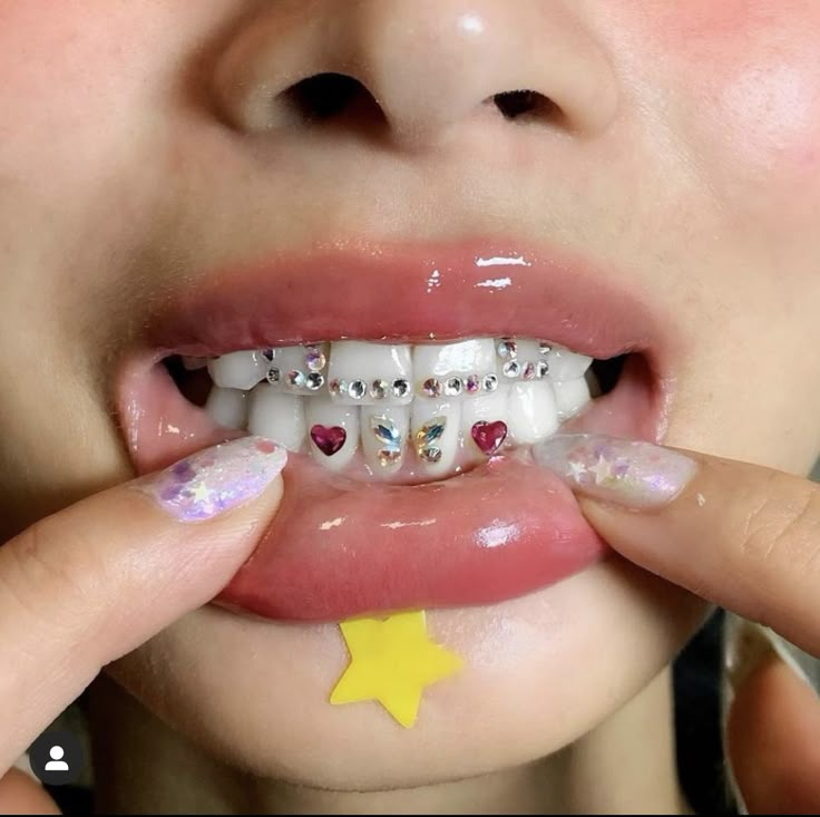 Tooth Gem Designs, Tooth Gem Ideas, Tooth Gems Ideas, Bunny Teeth, Teeth Gems, Pretty Teeth, Dental Jewelry, Grillz Teeth, Tooth Jewelry