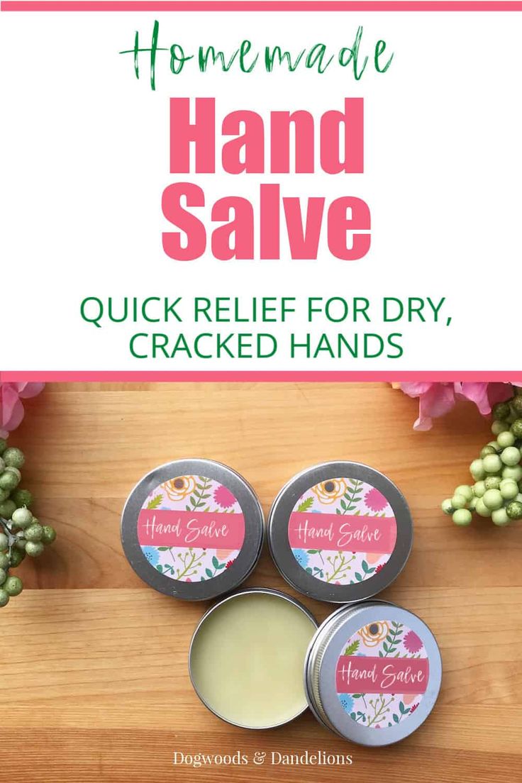 Gardening can really dry out your hands. This easy homemade gardener's salve will soothe your skin with nourishing ingredients. Made with only 5 ingredients, this is a perfect gift for Mother's Day. #dogwoodsanddandelions #DIY #giftideas Diy Hand Moisturizer, Dry Hands Remedy Diy, Cracked Hands Remedy, Diy Hand Lotion, Hand Lotion Recipe, Diy Balm, Dry Hands Remedy, Diy Salve, Hand Cream Recipe