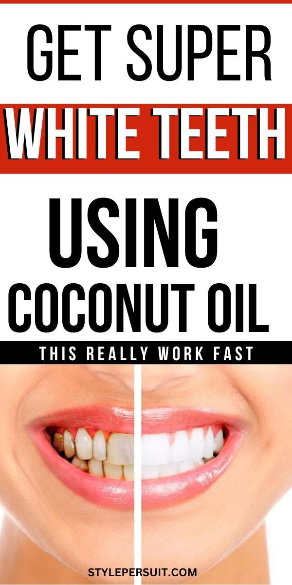 TIred stained teeth or yellow teeth. Are you looking natural way to whien your teeth? Coconut oil is an effective natural ingredient for teeth whitening. Learn how to whiten teeth with coconut oil for a great oral hygiene and health teeth. Strengthen Teeth, Teeth Whitening Remedies, Teeth Whitening Diy, Whiten Teeth, Yellow Teeth, Stronger Teeth, Gum Care, Receding Gums, Stained Teeth