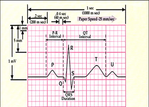 Ekg Interpretation, Vascular Ultrasound, Ecg Interpretation, Medical Assistant Student, Paramedic School, Nursing Information, Nursing Cheat, Medicine Studies, Vet Medicine