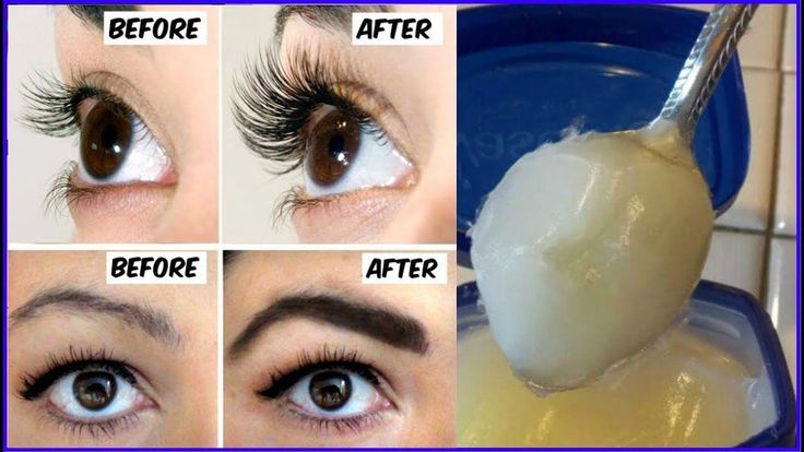 This remedy is for long and thick eyelashes and eyebrows.this remedy will grow your lashes and make them long, thick and healthy You can use this remedy to m... Coconut Oil And Vaseline For Eyelashes, Eyebrow Growth Remedies, Strong Eyebrows, Grow Eyebrows Faster, Thick Hair Solutions, Grow Eyebrows, Grow Eyebrows Thicker, Thicker Eyebrows, Aloe Cream