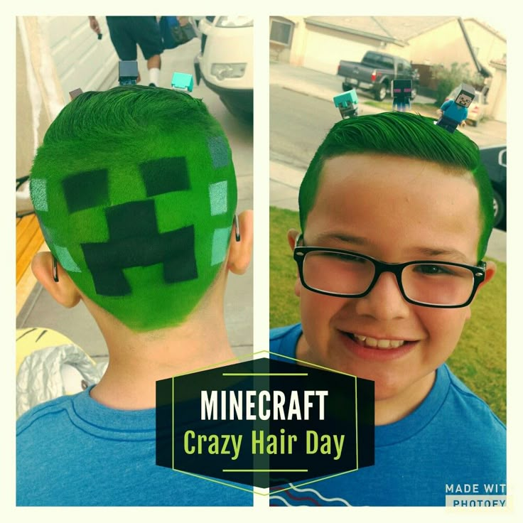 MINECRAFT Crazy Hair Day- Adam Crazy Hair Boys, Crazy Hat Day, Acne Treatments, Wacky Hair Days, Crazy Hats, Crazy Hair Day, Wacky Hair, Crazy Day, Crazy Hair Day At School