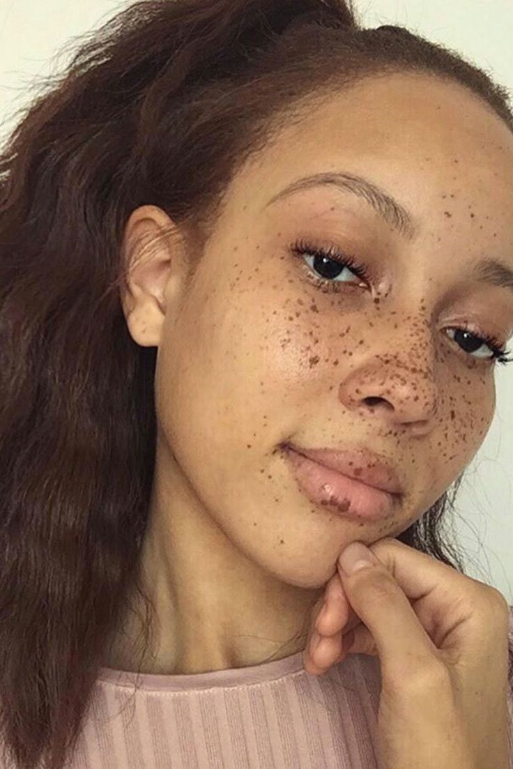 Fab and Freckled | These teeny speckled wonders look absolutely beautiful against brown skin. Freckles On Face, Black Girls With Freckles, Black Freckles, Tattooed Freckles, People With Freckles, Women With Freckles, Freckles Makeup, Beautiful Freckles, Faux Freckles