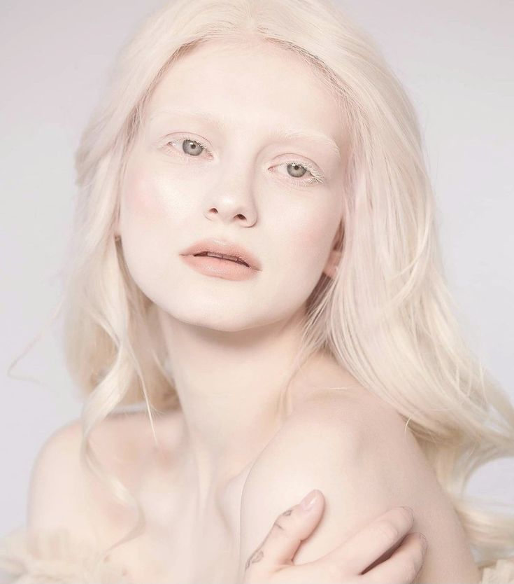 #albinogirl #albino #albinism #whitehair #white Albino Hair, Albino Girl, Candle Girl, Angels Beauty, Arte Peculiar, Targaryen Aesthetic, Favorite Hairstyles, Skin Conditions, Replica Handbags