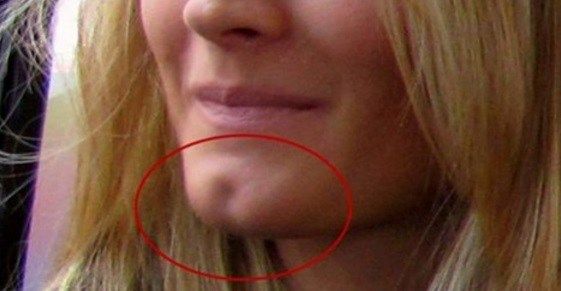 What the “Beauty” Hole on Your Chin Says About You People With Dimples, Woman Personality, You Are Special, John Travolta, Unwanted Hair Removal, Unwanted Hair, Wrinkle Remover, Facial Care, Fat Burning