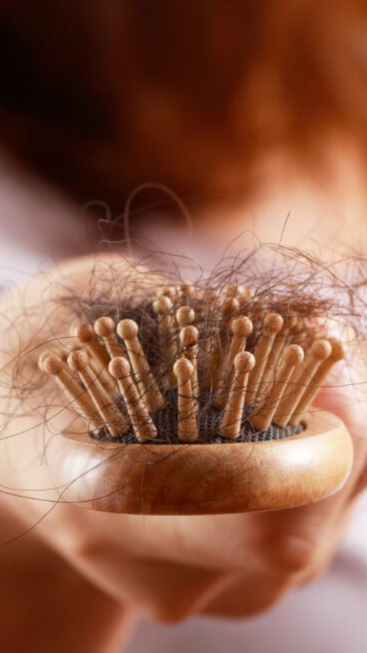 WHY IS MY HAIR FALLING OUT? 9 TRIGGERS OF HAIR LOSS IN WOMEN (AND WHAT TO DO ABOUT IT) | Click The Link To Find Out More https://channeling.com/blog/why-is-my-hair-falling-out-9-triggers-of-hair-loss-in-women-and-what-to-do-about-it/ #health #tips #self #hairloss #reasons #women #hair #explanation #channeling Hair Falling, Breaking Hair, Hair Shedding, Hair Control, Happier Life, Lost Hair, Hair Problems, Hair Follicle, Hair Health