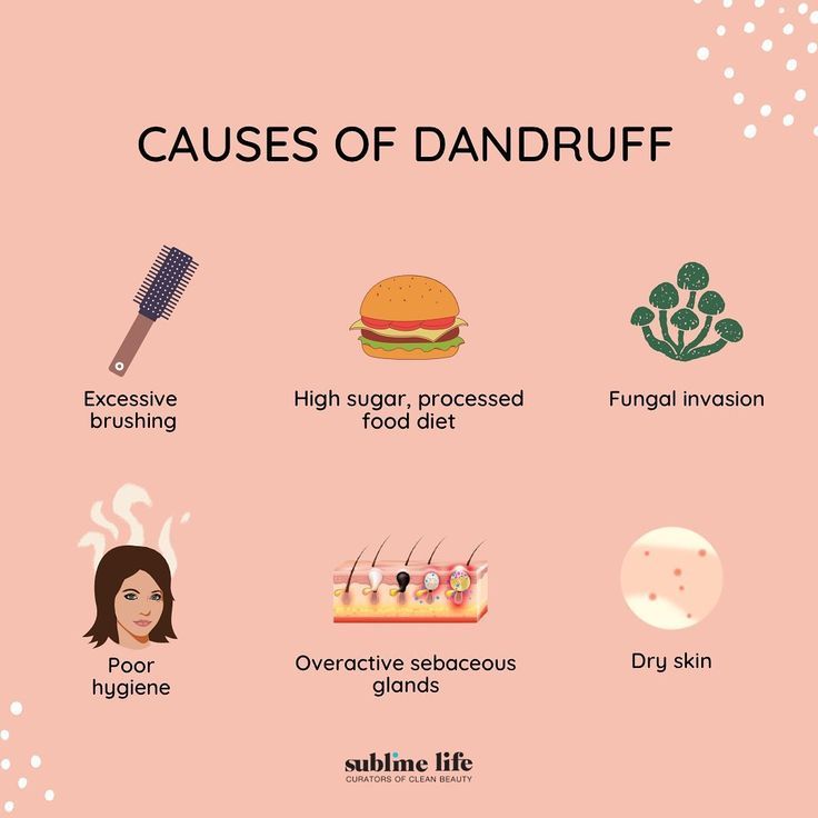 Dandruff are the telltale patches of white flakes on the scalp, made up of dead skin, that come loose in your hair. You might spy these flakes in your hair or on your shoulders. Dandruff may make your scalp itchy, too. But what really causes them? Wonder no more as we state the reasons for you! Hair Fall Control Tips, Hair Mask For Dandruff, Dandruff Hair, Healthy Hair Routine, Dandruff Remedy, Getting Rid Of Dandruff, Hair Mistakes, Hair Dandruff, Hair Control