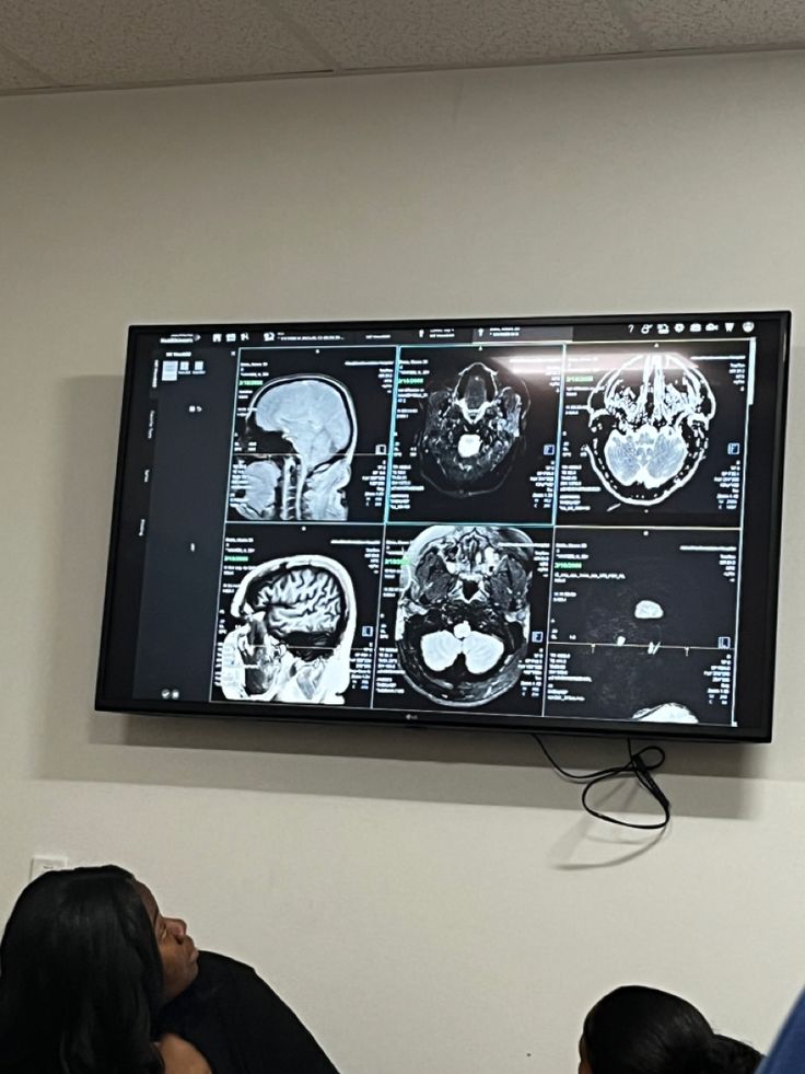 two people sitting in front of a large television screen with mri images on the wall