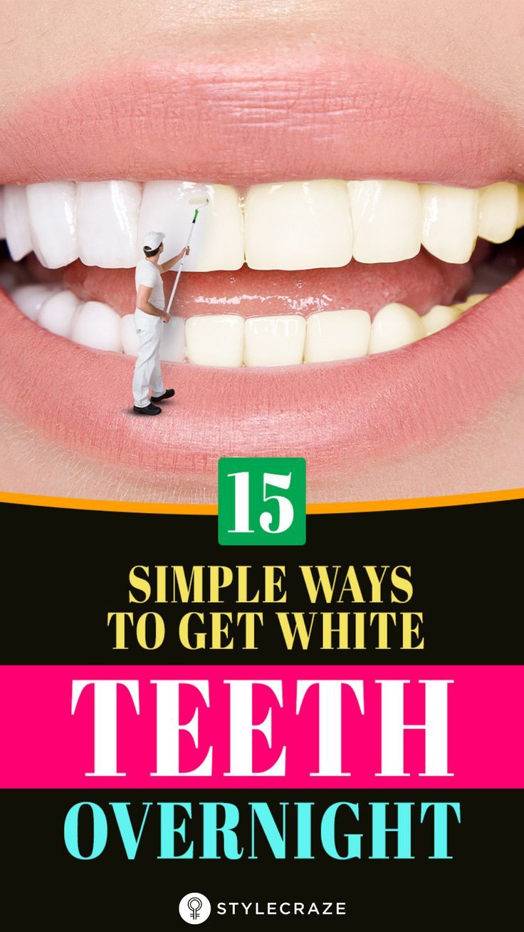 White Teeth Overnight, Grow Back Receding Gums, Teeth Remedies, Teeth Whitening Methods, Get Whiter Teeth, Heal Cavities, Teeth Whitening Diy, Whiten Teeth, Yellow Teeth